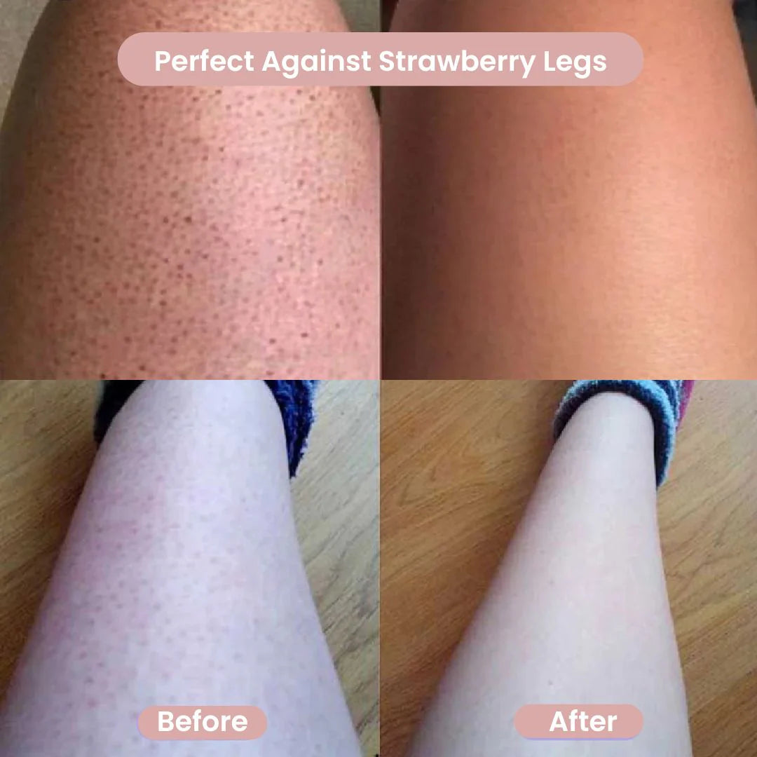 SilkEase™ – 2-in-1 Women’s Body Shaver