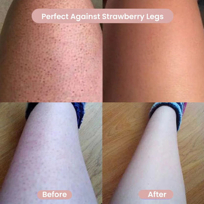SilkEase™ – 2-in-1 Women’s Body Shaver