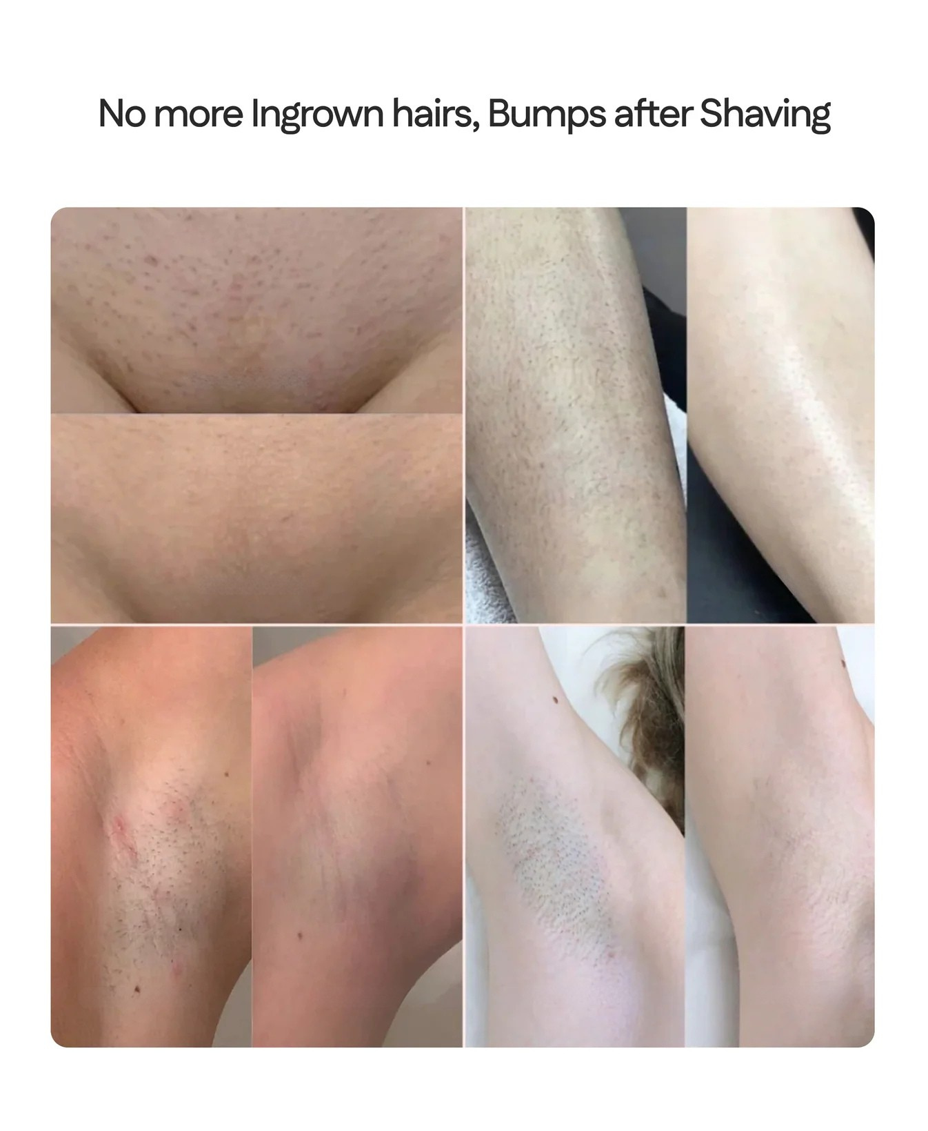 SilkEase™ – 2-in-1 Women’s Body Shaver